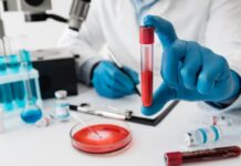 Ki az a hematológus és miben segíthet? hematológus