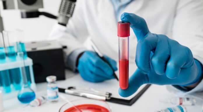 Ki az a hematológus és miben segíthet? hematológus